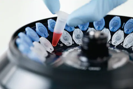 Eppendorf_Safe-Lock_Rør